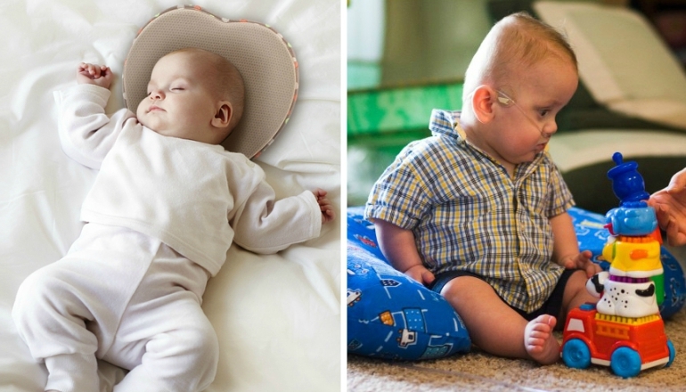 How to Prevent Infant Flat Head Syndrome?