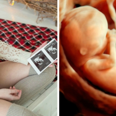 19 Pregnancy Myths Hint at Your Baby's Gender