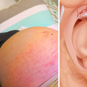 9 Pregnancy Facts Every Woman Should Know