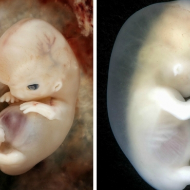 Baby in the Womb: Real Footage of Developing Fetus