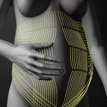 Diastasis Recti: Why The Dia Method Works?