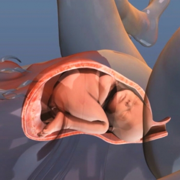 Episiotomy: How That Might Be Used During Labor to Ease Delivery of the Baby?