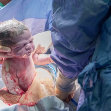 Gentle C-section: Liam's Birth Story