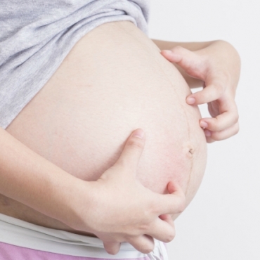 How to Deal with an Itchy Pregnancy Stomach?