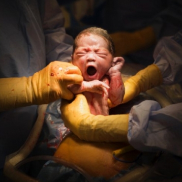 How to Have a Positive Cesarean Delivery