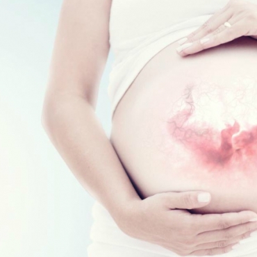 How to Monitor Your baby's Movements or Count the Kicks