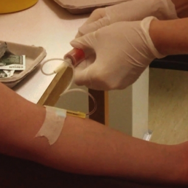 How to Test for Down Syndrome While Pregnant?