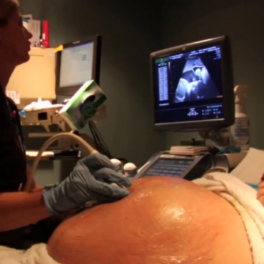 Miracle Multiples: We're Having Triplets