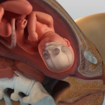 Normal Spontaneous Vaginal Delivery