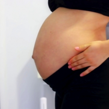 Pregnancy Hacks: How to Prevent Stretch Marks?