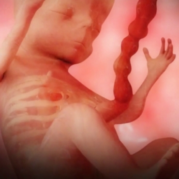 Pregnancy Week 17 - Four Months Pregnant