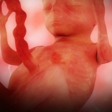 Pregnancy Week 18 - Five Months Pregnant