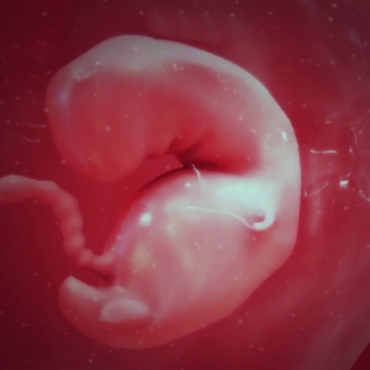 Pregnancy Week 4 - One Months Pregnant