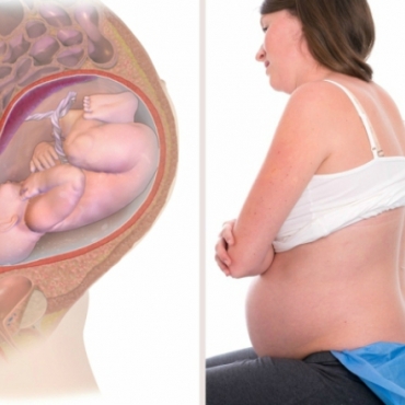 Pros and Cons of an Epidural During Labor