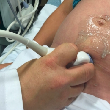 Should You Get Genetic Testing During Your Pregnancy?