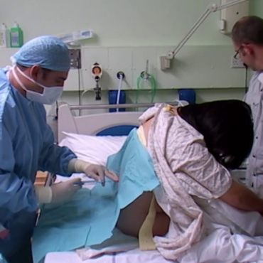 Step-by-Step Epidural Procedure for Labor