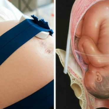 The Second and Third Stage of Labour