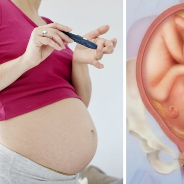 Understanding Gestational Diabetes