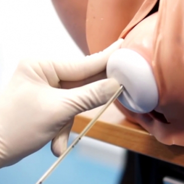 Ventouse Delivery (Vacuum Extraction) Technique