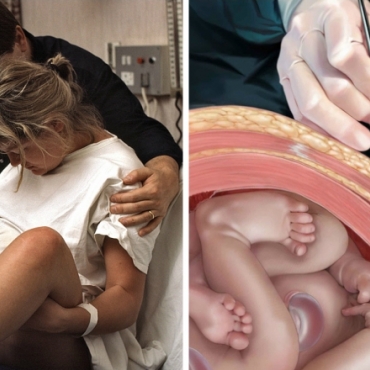 What Happens During Vaginal Birth and Cesarean Section?