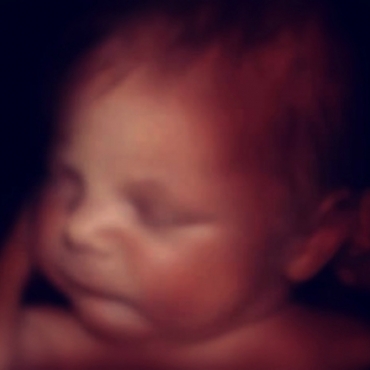 What is Happening at 38 Weeks Pregnant?