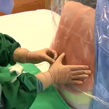 What You Need to Know About Epidural Anaesthesia