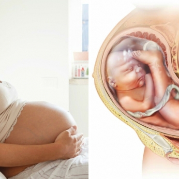 Why Are Babies Breech?